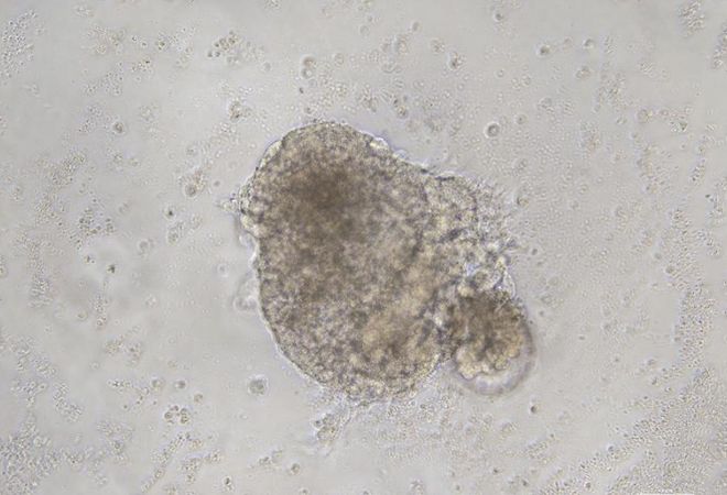 字节红杉数千万美元持续加注3D生成大模型；3D打印心脏现场跳动；海外金属打印企业完成收购案(图3)